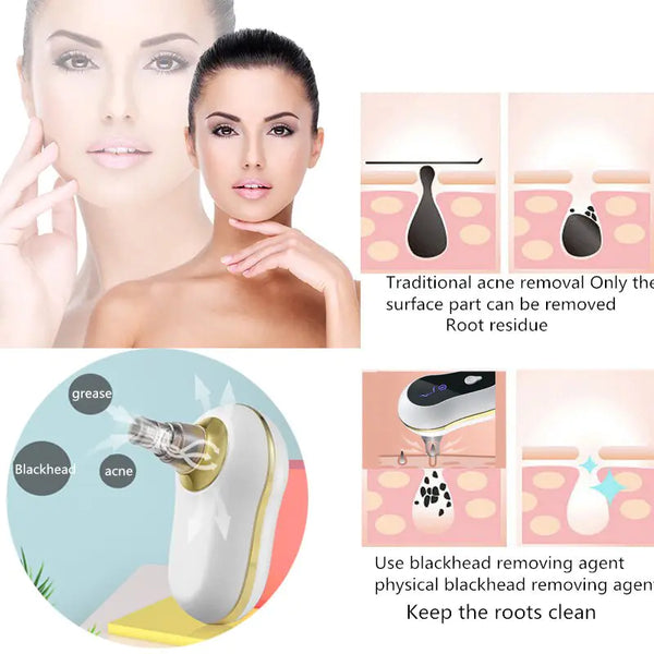 vacuum suction clean skin care:RevitalizeYour Skin with Powerfulvacuum